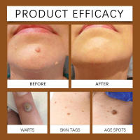 La crema para el cuidado de la piel HOUKEA tiene ingredientes suaves que hidratan suavemente la piel. Limpie el cuerpo y aplique crema para el cuidado del masaje. - details 9