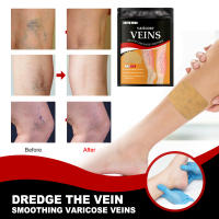 Parche de Cuidado de Venas Alivio de Oclusión de Vena Varicoidal y Hinchazón de Pies - details 1