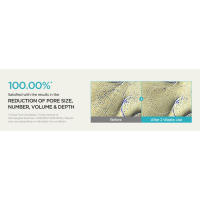 ANUA BHA 2% Tónico exfoliante suave, exfoliante facial suave, ácido salicílico para poros y sebo, extracto de árbol de té, hialurónico - details 4