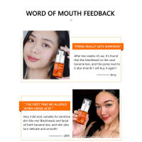 VIBRANTE GLAMOUR Cuidado de Belleza para Refinar Poros Herramientas de Cuidado de Piel Facial - details 11