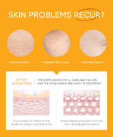 3 unids/set LAIKOU vitamina C 24K Golden Sakura juegos de cuidado de la piel crema facial suero crema para ojos hidratante antiarrugas Kit de cuidado facial - details 11