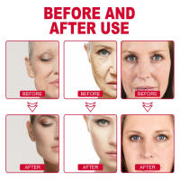 Crema de eliminación instantánea de bolsas de ojos, Retinol, antiarrugas, se desvanecen, líneas finas, piel firme, antiojeras, masaje de contorno de ojos, cuidado brillante - details 9