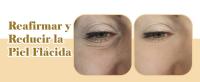 Dispositivos de terapia, luz roja SkinAngel para la cara, el cuello Skin Tightening Varita, Nuderma para la eliminación, arrugas, rejuvenecimiento, la piel (Terapia de luz roja para la cara) - details 8