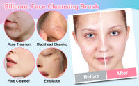 Facial Cleansing Brush