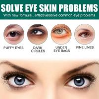 Crema para ojos de aguacate, eliminación de ojeras, bolsas para los ojos, hinchazón, cremas hidratantes antiarrugas para los ojos, productos para el cuidado de la piel - details 3