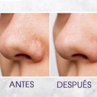 Cepillo de limpieza facial, cepillo facial electrico, skincare