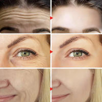 Instantánea Firmación y Elevación de la Piel Removedor de Arrugas Retinol - details 5