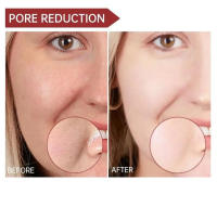 Crema Reductora de Poros Adiós a los Poros Grandes Gel Reparador de Acné Suavización de la Piel - details 8