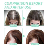El romero nutre suavemente ilumina el cabello, hidrata y suaviza el aceite esencial para el cuidado del cabello - details 8