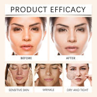 La crema calmante para el cuidado de la piel con propóleo reduce el enrojecimiento, la opacidad, la suavidad, la hidratación, la nutrición, el rejuvenecimiento y. - details 11