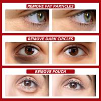 Sérum de Eliminación de Gránulos de Ojo de 30ml Efectivo contra Partículas, Mejora el Enrojecimiento, Cuidado de la Piel de Belleza - details 8