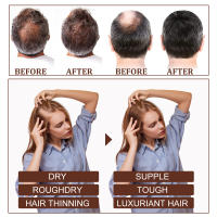 Aceite esencial de ricino que repara el cuero cabelludo nutritivo dañado, esencia reafirmante densa antipérdida de cabello - details 5