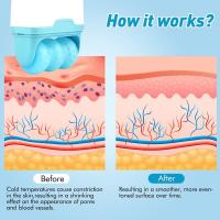 Scttomon Rodillo de Hielo Herramienta de Cuidado de la Piel Facial para Estrechar, Iluminar, Reducir Arrugas Regalo Ideal para Mujeres - details 5