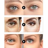 Sérum para Ojos de Retinol Ilumina tu Mirada, Adiós a las Ojeras, Reafirma tu Piel - details 7