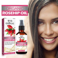 El aceite de rosa para cabello grueso hidrata, nutre el cabello, alivia la sequedad, fortalece la dureza, solidifica y previene. - details 1