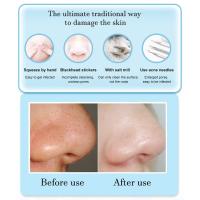 Limpiador de Poros faciales, Limpieza Profunda, Eléctrico, recargable, Cabeza Negra, mascarilla Facial, succión al vacío, Eliminator de espinillas - details 4