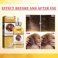El líquido de crecimiento nutre, reafirma, solidifica el cabello, mejora la reparación, fortalece las raíces y previene la caída del cabello. - details 8