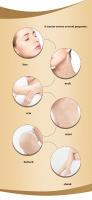 Masajeador Facial para el rejuvenecimiento de la piel, Radio de mesoterapia EMS LED, Lifting Facial, vibración Sónica, eliminación de arrugas, herramientas RF antienvejecimiento - details 3