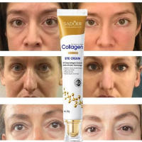 Crema para los Ojos Anti-Hinchazón Reductor de Granos de Grasa Refuerza la Barriera de Piel - details 14