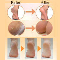 Calcetines para fascitis Plantar, almohadillas para aliviar el dolor de los pies agrietados, cojín para el talón, cuidado de los pies - details 9