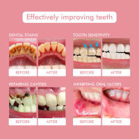 Dientes con sabor a melocotón, aliento fresco y duradero, enjuague bucal portátil para limpiar las encías - details 7