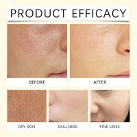 La vitamina C iluminadora hidrata calma la piel del rostro, leche limpiadora hidratante y no restringente. - details 8