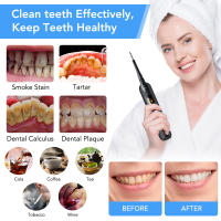 Kit de blanqueamiento Dental eléctrico, raspador Dental con espejo para la boca, para eliminar manchas de sarro cuidado bucal, limpiador de dientes - details 4