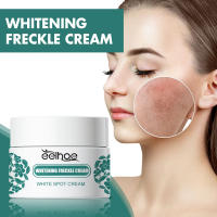 Crema iluminadora de niacinamida y Melasma, crema iluminadora de melanina, aclara la piel oscura, suero de cloasma que desvanece las líneas finas, cuidado facial - details 1