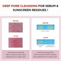 SKIN1004 es Madagascar Spark Cleanser Deep Cleaner 4.22 fl.oz, 125 ml, elimina los restos de poros obstruidos - details 3