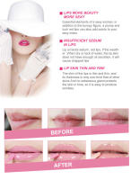 Juego de Cuidado de la Piel de Labios Hidratante y Nutritivo 20pcs Máscaras para Ojos y Labios para Rejuvenecer y Eliminar Ojeras - details 3