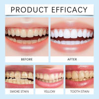 Pasta de dientes esmaltada para una limpieza suave, eliminación de manchas, cuidado fresco e higiene dental - details 7