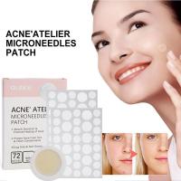 Parches de Tratamiento de Acné de Punto Micro 72 Counts para Tratamiento de Pimientos - details 2