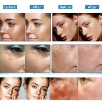 Crema Blanqueadora Astragalus Removedor de Manchas Dark Spots Reparador de Piel Hidratante - details 7