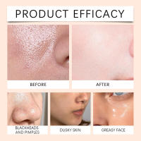 Gentle Exfolia Cleanser limpia suavemente la piel, dejándola fresca sin sentirse apretada, hidratando y - details 11