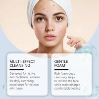 Limpiador de ácido salicílico para limpieza facial, blanqueamiento de poros, reducción del acné, cuidado hidratante suave - details 6