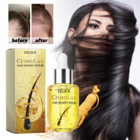 Previene la caída, nutre el cabello, cuidado del cuero cabelludo, esencia densa para el cuidado del cabello - details 1