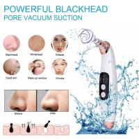 Extractor de Puntos Negros, Extractor Eléctrico de Puntos Negros al Vacío, Herramienta de Limpieza, Instrumento de Belleza con 6 Sondas para la Eliminación de Puntos Negros, Limpiador Facial de Succión al Vacío - details 2