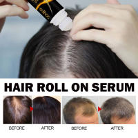Rolling hidrata el cabello, mejora la furia de la cola y el aceite esencial para el cuidado del cabello esponjoso - details 8