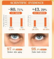 Crema Instantánea para Ojos de Retinol Reducción de Arrugas, Reafirmación de Piel, Desvanecimiento de Ojeras, Iluminación de Ojos Herramientas de Cuidado de la Piel Facial - details 2