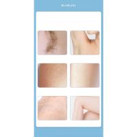 Blawless-dispositivo de depilación Facial 3 en 1 para mujer, Afeitadora eléctrica, 3 cabezales de repuesto - details 3