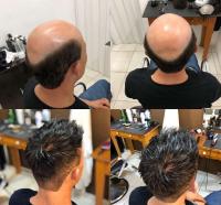 Q6 Base Prótesis capilar para hombres Línea de cabello invisible Sistema de cabello para hombres Peluca masculina de cabello humano natural Sistema de cabello masculino transpirable Q6 Base de piel Peluquín para hombres con nudos blanqueados - details 11