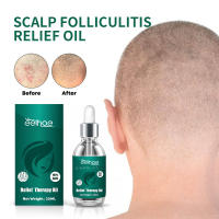 Cuero cabelludo limpieza profunda folículos caspa reparación cabello suavizante esencia de cuidado - details 1