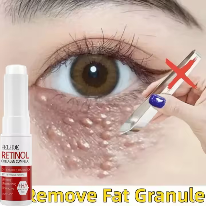 Crema reafirmante antihinchazón para eliminación de gránulos de grasa, crema antiinflamatoria que se desvanece, línea fina, reparación de barrera de la piel, cuidado de la piel coreano - 1