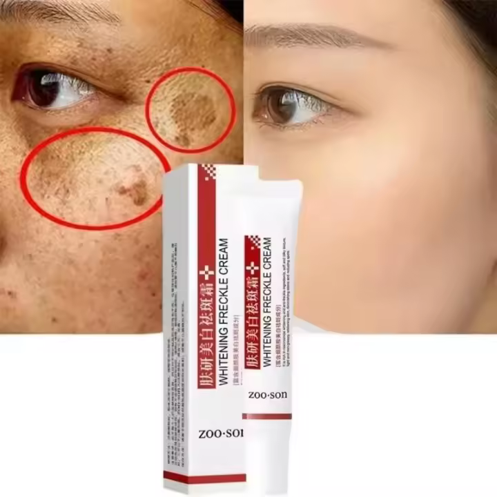 Suero Blanqueador Corrector de Manchas Dark Spots Iluminador de Piel Cuidado de Belleza Coreano - 1