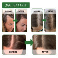Batana esencial para reparar, fortalecer, reafirmar, prevenir la caída y nutrir el aceite para el cabello del cuero cabelludo - details 8