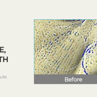 ANUA BHA 2% Tónico exfoliante suave, exfoliante facial suave, ácido salicílico para poros y sebo, extracto de árbol de té, hialurónico - details 12