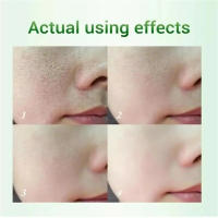 Crema de reducción de poros con ácido salicílico, Reduce los poros grandes, aprieta la refinación, repara los poros ásperos y opacos, ilumina el cuidado de la piel - details 2