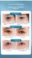 Dispositivo de belleza ocular, Crema para Ojos vibratoria, Reduce las líneas de expresión - details 18