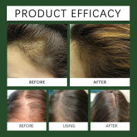 El romero promueve un crecimiento saludable y nutritivo, resistente a los aceites esenciales para el crecimiento del cabello. - details 8