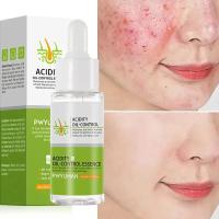 Crema Reductora de Poros de Ácido Salicílico Adiós a los Pulgares, Reparación de Piel, Estiramiento - details 21